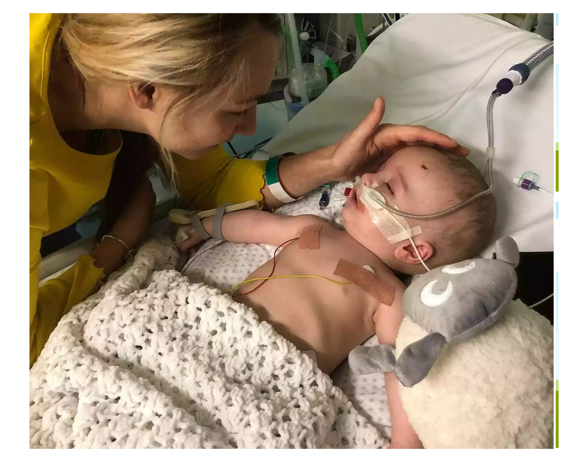 Baby Michael wakes from a five-day coma and smiles at his father while battling a rare cardiac fibroma heart tumor.